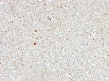 Calretinin Antibody / CALB2 / Calbindin 2