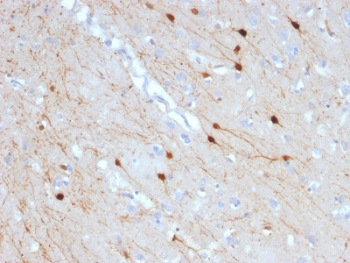 Calbindin 2 Antibody / CALB2 / Calretinin