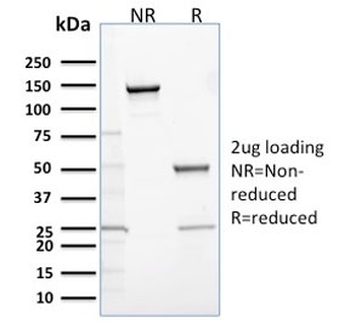 Calbindin 2 Antibody / CALB2 / Calretinin