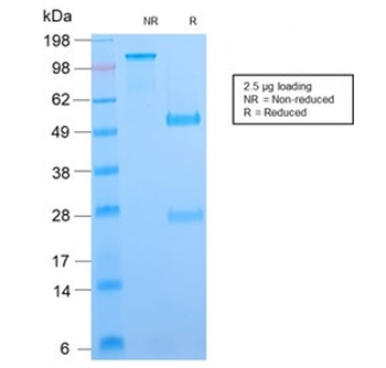 Recombinant B7-H4 Antibody / VTCN1