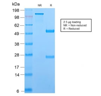 Recombinant TCL1 Antibody