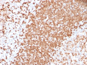 Recombinant TCL1 Antibody