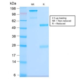 Recombinant CD63 Antibody / LAMP-3