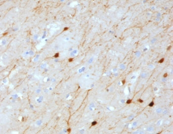 Calretinin Antibody / CALB2 / Calbindin 2