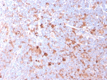 CD40 Ligand Antibody / TRAP / CD154