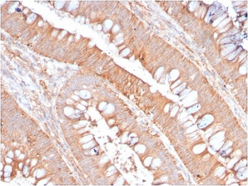 Recombinant CD59 Antibody