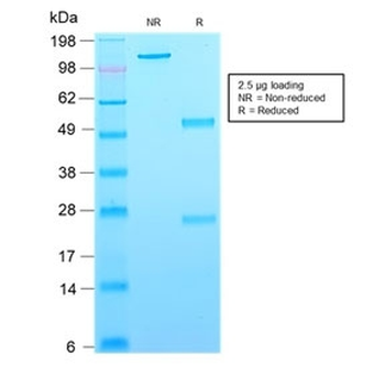 Recombinant CD63 Antibody / LAMP-3