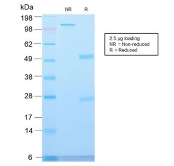 Recombinant MVP Antibody / Major Vault Protein