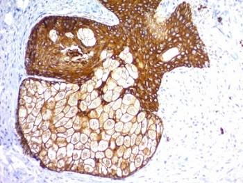 Recombinant Pan Cytokeratin Antibody Cocktail
