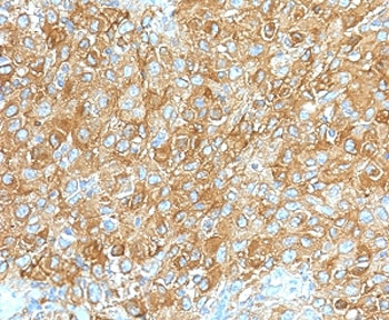 Recombinant CD63 Antibody / LAMP-3