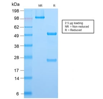 Recombinant ALK Antibody / Anaplastic Lymphoma Kinase