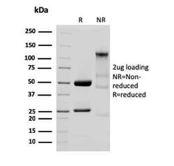 Recombinant GP2 Antibody / Glycoprotein 2 / ZAP75