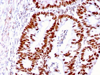 MSH6 Antibody