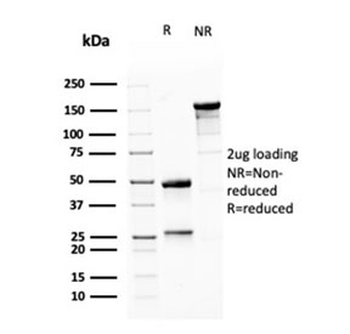 MSH6 Antibody