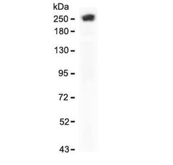 Recombinant SPTA1 Antibody / Spectrin alpha 1