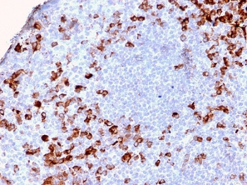 Recombinant Kappa Antibody