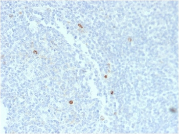 Recombinant IgM Heavy Chain Antibody