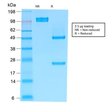 Recombinant IgM Heavy Chain Antibody