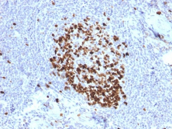 Ki-67 Antibody
