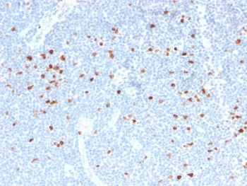 Ki-67 Antibody