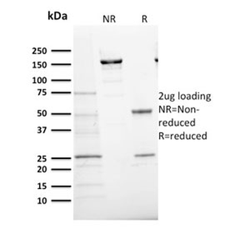 Ki-67 Antibody