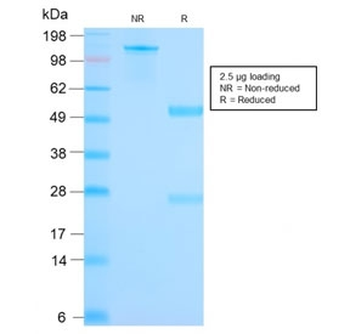 Recombinant Mammaglobin Antibody / SCGB2A2