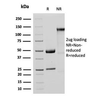 Recombinant MTAP Antibody / S-methyl-5'-thioadenosine phosphorylase