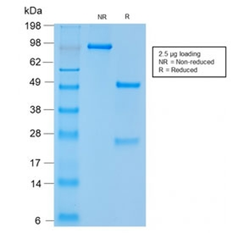 Recombinant CD56 Antibody