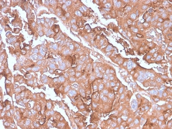 Recombinant MUC1 Antibody / Mucin-1