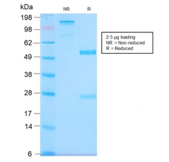 Recombinant MUC1 Antibody / Mucin-1