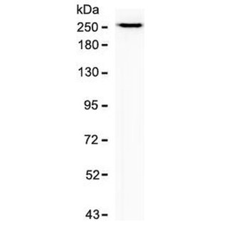 Recombinant SPTBN2 Antibody / Spectrin beta III