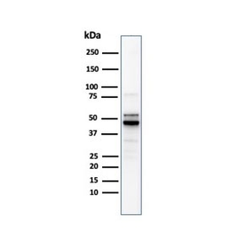Recombinant ODC1 Antibody