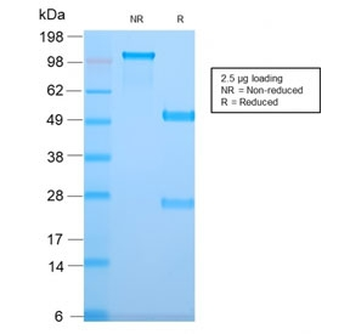 Recombinant TMEM16A Antibody / DOG1 / ANO1