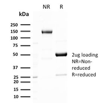 Recombinant GLUT1 Antibody