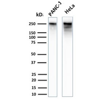 Recombinant Spectrin beta III Antibody / SPTBN2