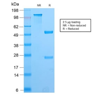 Recombinant PAX8 Antibody
