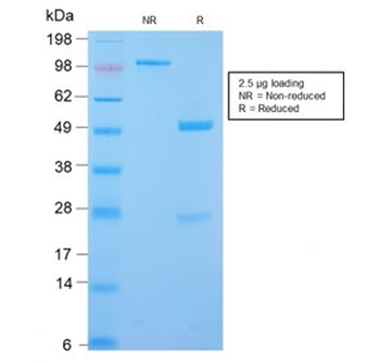 Recombinant Desmin Antibody