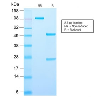 Recombinant AMACR Antibody / p504S