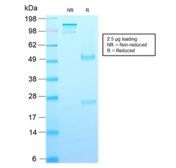 Recombinant GH Antibody (pituitary) / Growth Hormone