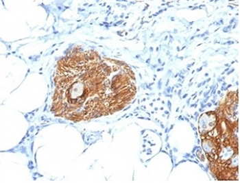 CD56 Antibody