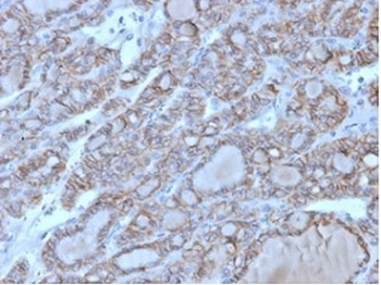CD56 Antibody
