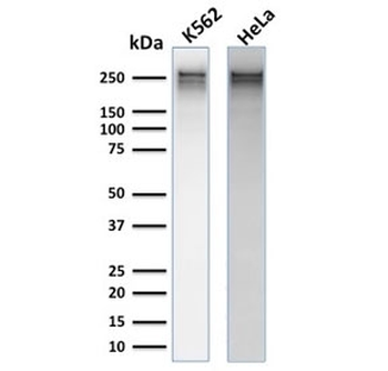 Recombinant Spectrin alpha 1 Antibody / SPTA1