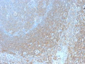 Recombinant Bcl10 Antibody