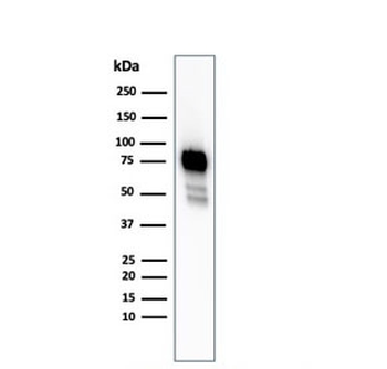 Recombinant CD44 Antibody
