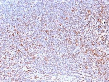 Recombinant Nuclear Marker Antibody
