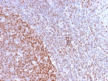 Recombinant Nuclear Marker Antibody