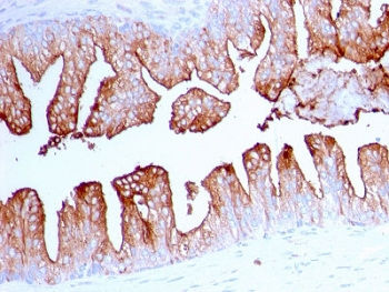 FOLH1 Antibody / PSMA