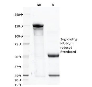 FOLH1 Antibody / PSMA