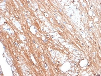 FOLH1 Antibody / PSMA
