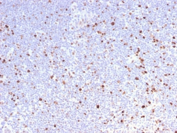 Recombinant MCM7 Antibody